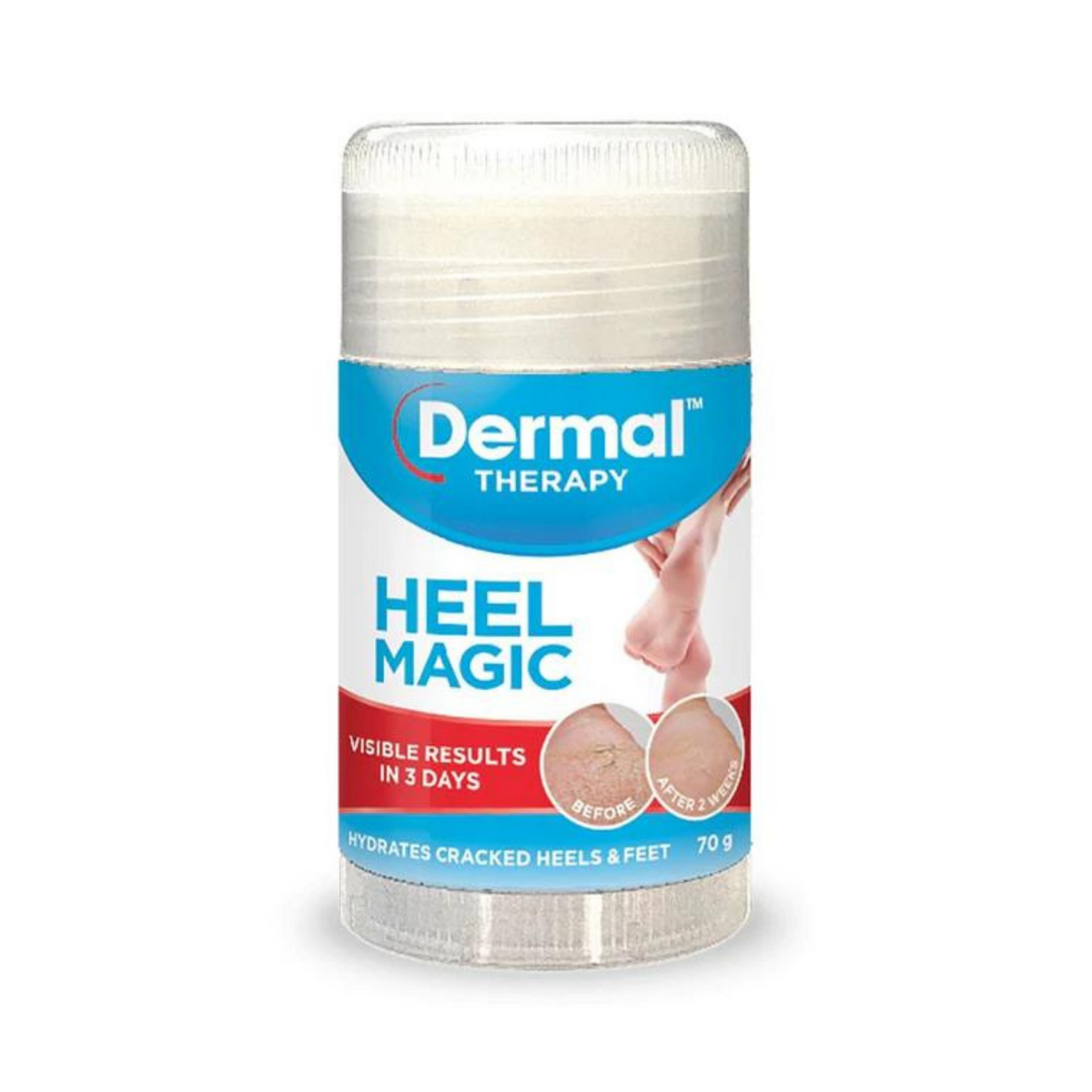 Dermal Therapy Heel Magic 70g